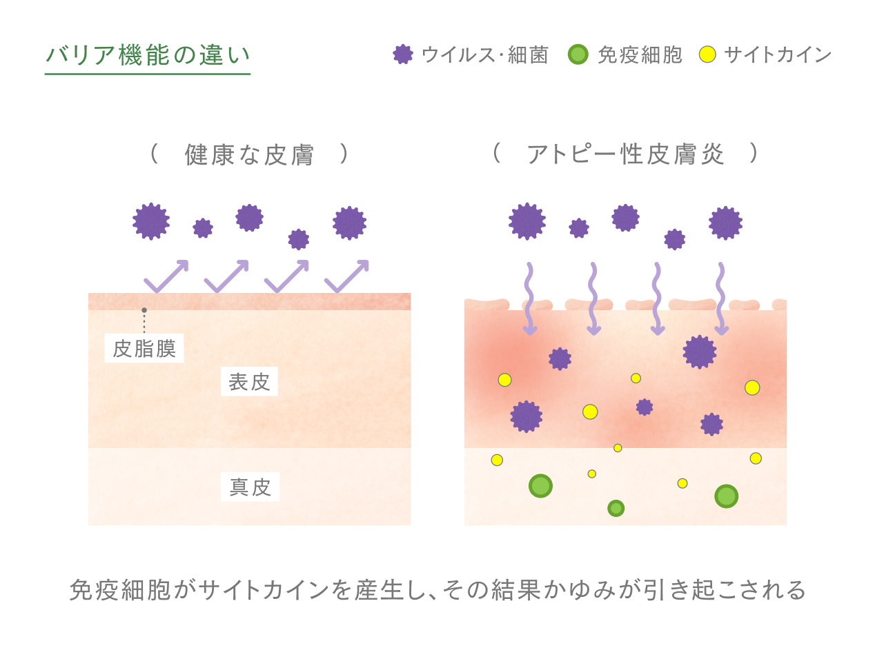 かゆみが引き起こされるしくみの図