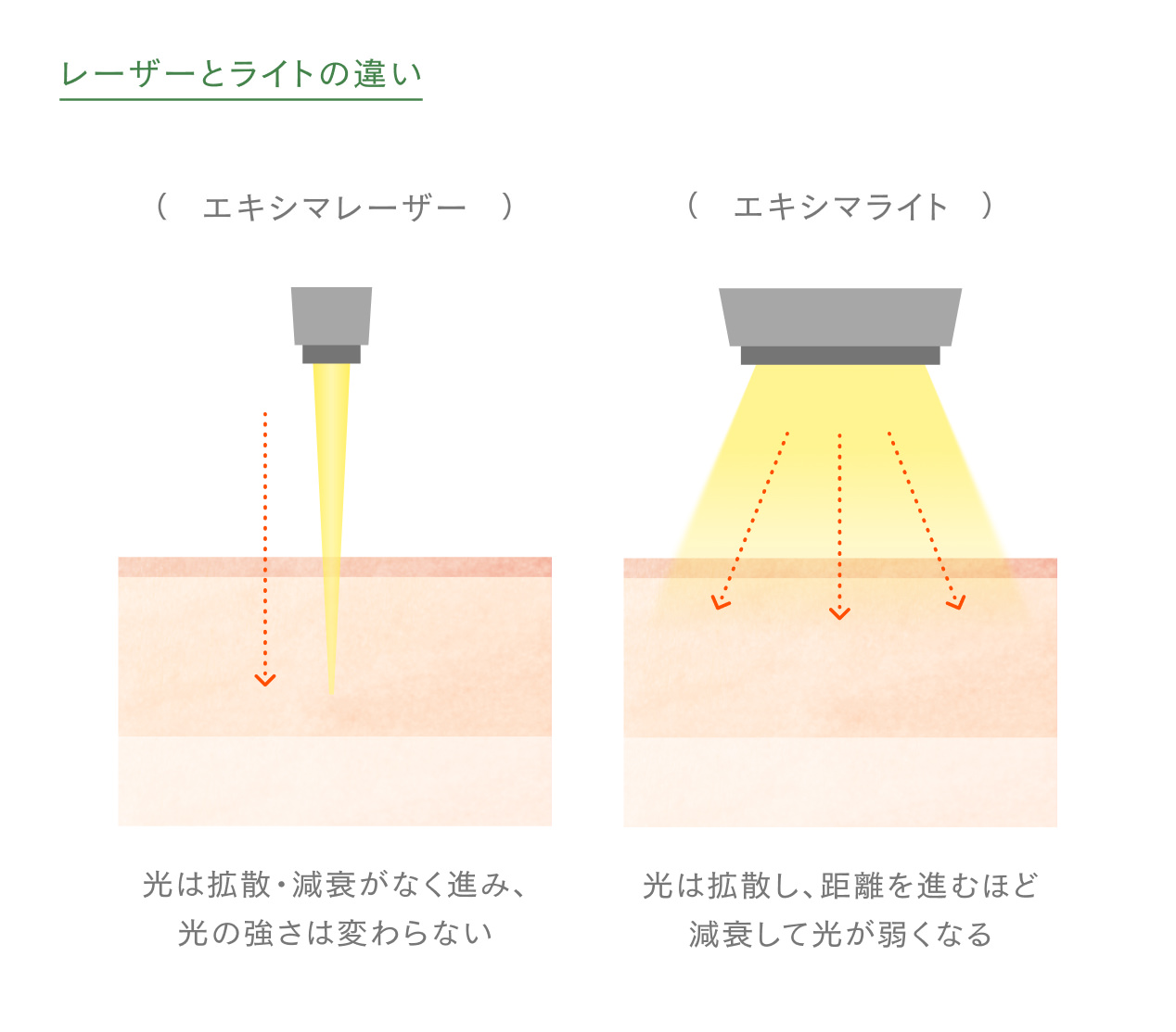 レーザーとライトの違いを表した図